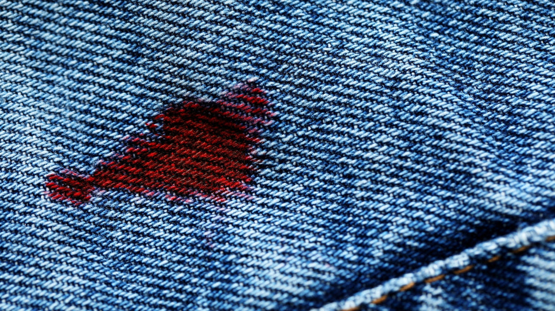 Tache de sang : ce qu’il ne faut surtout pas faire